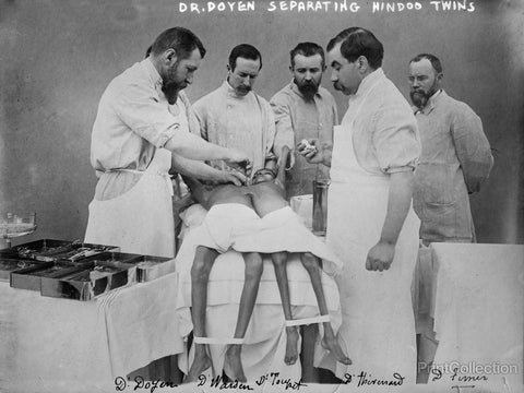 Dr. Doyen Separating Hindoo Twins Dr. Doyen Separating Hindoo Twins